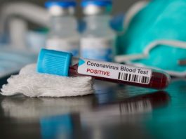 Maroc- Coronavirus : 196 nouveaux cas confirmés 503 Tunisiens atteints du coronavirus à Qatar