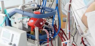 Une patiente vainc le Coronavirus grâce à la technique du poumon artificiel